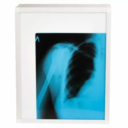 Негатоскоп TAGLER НЛ-1 1-кадровый 