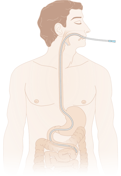 Зонд (катетер) дуоденальный с РКП MEDEREN 125 см закрытый конец 