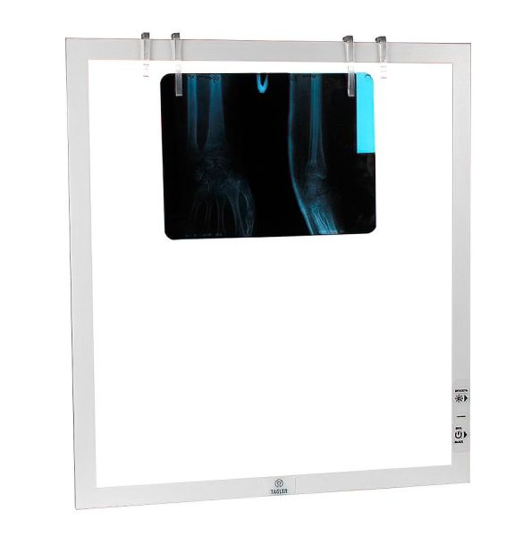 Негатоскоп TAGLER НСД-1 1-кадровый светодиодный